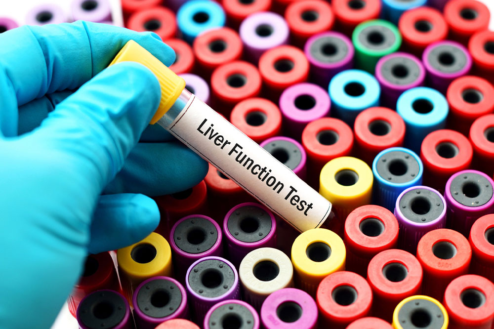 Liver function tests – Purpose, types, and procedure